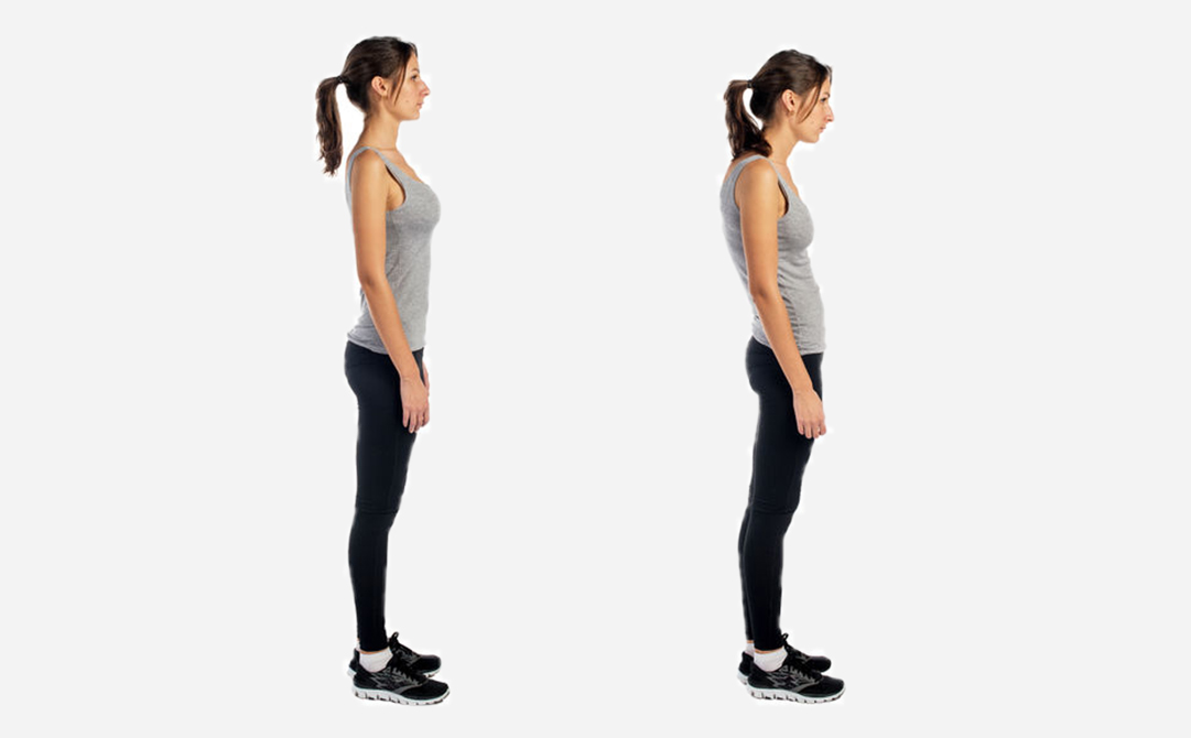 POSTURE AND ALIGNMENT PROBLEMS TREATMENT
