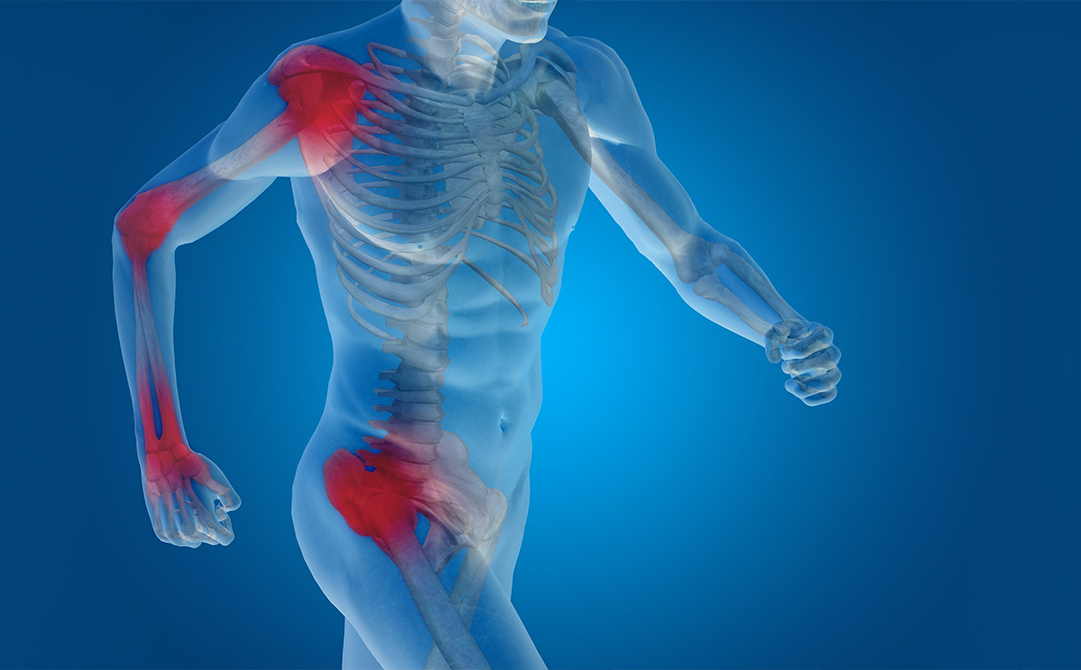 Muscle Joint Pain